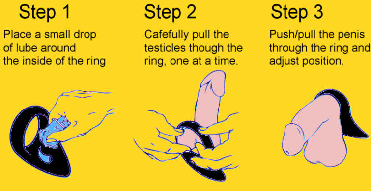 Picture position of cock ring